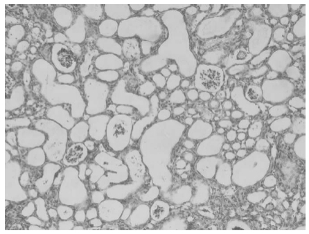 Serieintroduktion till aktiva folatföroreningar: ① Avslöjar effekten av 5-metyltetrahydropteroic acid.